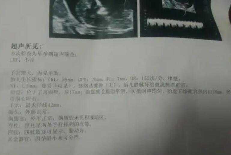 杭州提供助孕的公司有哪些 杭州试管婴儿医院 ‘24三维彩超男女’